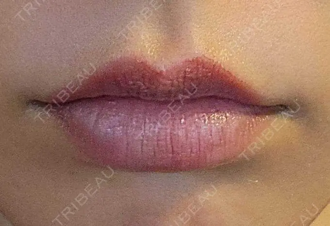 アートメイク（唇） エイトビューティークリニック 新宿院 DAY 3 メイン用