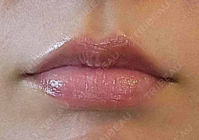 アートメイク（唇） エイトビューティークリニック 新宿院 DAY 19 メイン用