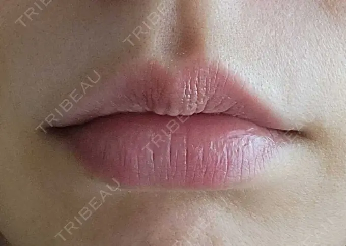 アートメイク（唇） エイトビューティークリニック 新宿院 DAY 28 メイン用