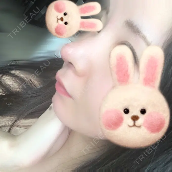 鼻尖形成（切開） / 軟骨移植 / 鼻尖縮小 / その他（鼻） みずほクリニック DAY 5 メイン用