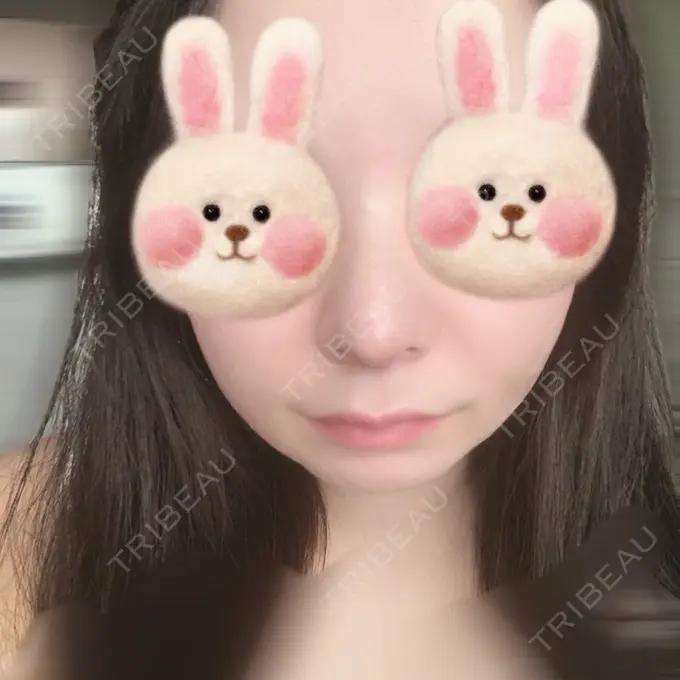 鼻尖形成（切開） / 軟骨移植 / 鼻尖縮小 / その他（鼻） みずほクリニック DAY 5 メイン用