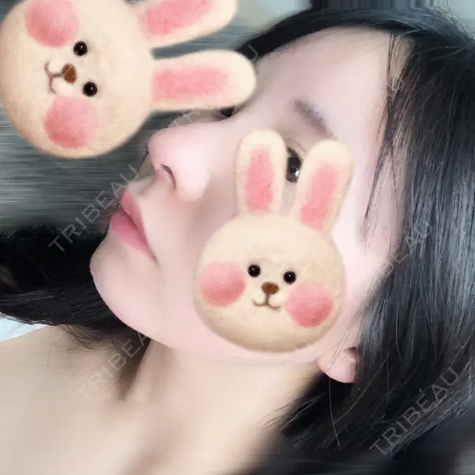 鼻尖形成（切開） / 軟骨移植 / 鼻尖縮小 / その他（鼻） みずほクリニック DAY 6 メイン用