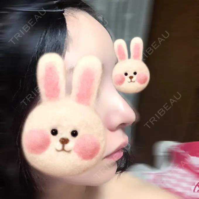 鼻尖形成（切開） / 軟骨移植 / 鼻尖縮小 / その他（鼻） みずほクリニック DAY 9 メイン用