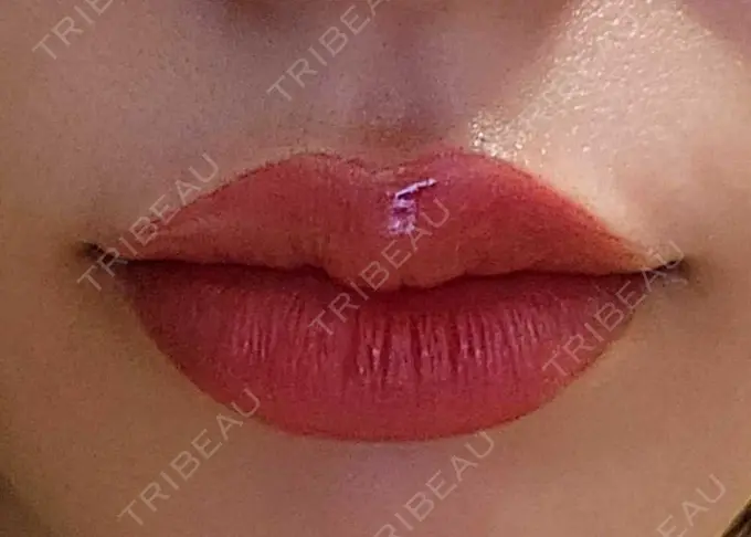 アートメイク（唇） エイトビューティークリニック 新宿院 DAY 69 メイン用