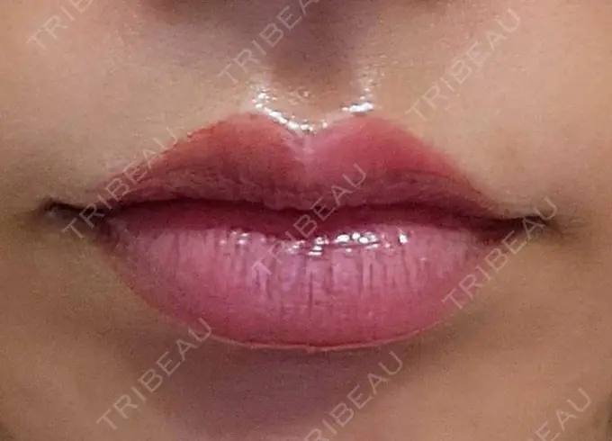 アートメイク（唇） エイトビューティークリニック 新宿院 AFTER メイン用