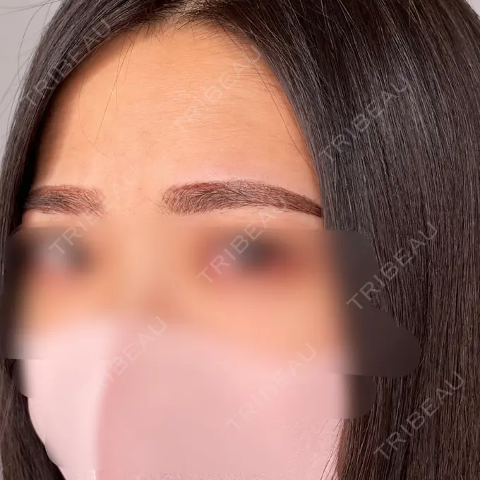 アートメイク（眉） 筋肉・美容クリニック DAY 35 メイン用