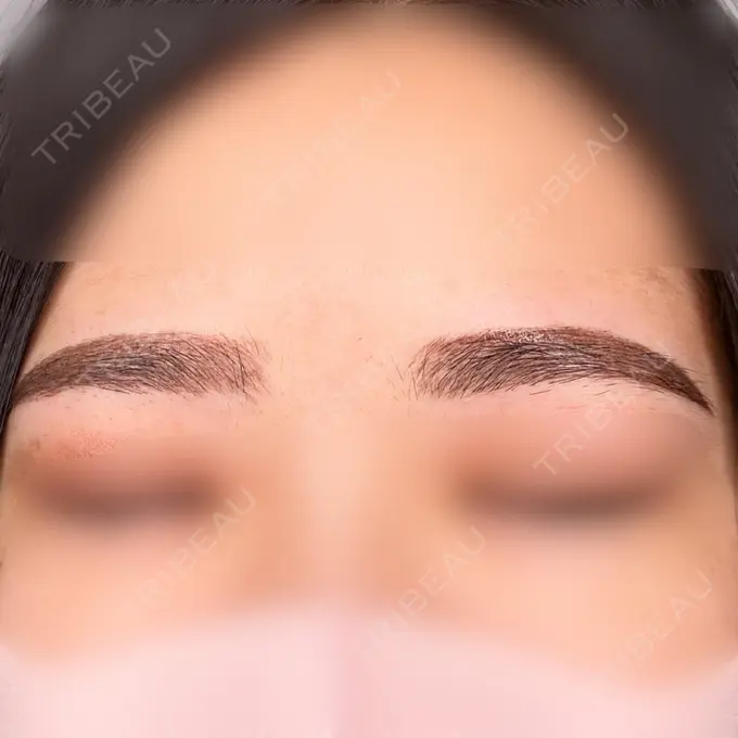 アートメイク（眉） 筋肉・美容クリニック DAY 35 メイン用