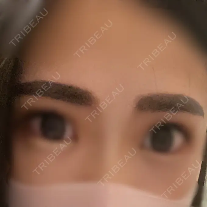 アートメイク（眉） 筋肉・美容クリニック DAY 36 メイン用