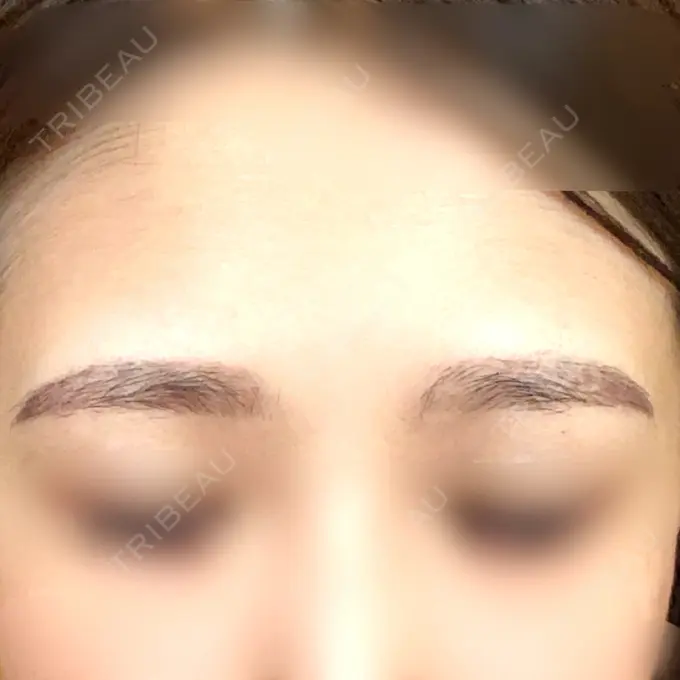 アートメイク（眉） 筋肉・美容クリニック DAY 52 メイン用