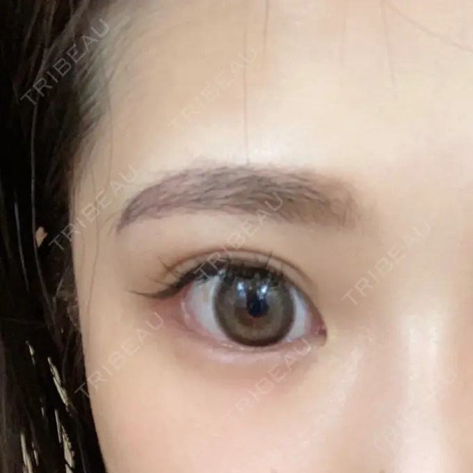 アートメイク（眉） 筋肉・美容クリニック DAY 52 メイン用