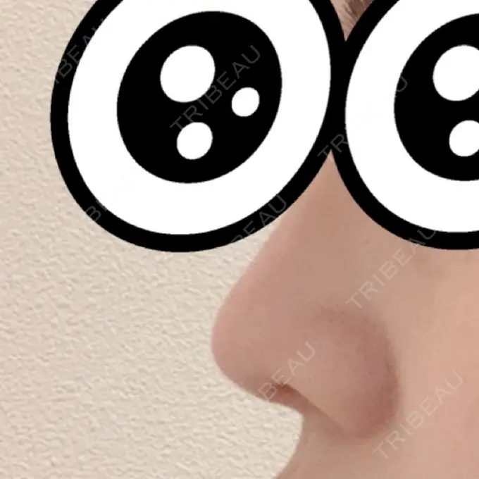 軟骨移植 GLANZ CLINIC DAY 14 メイン用