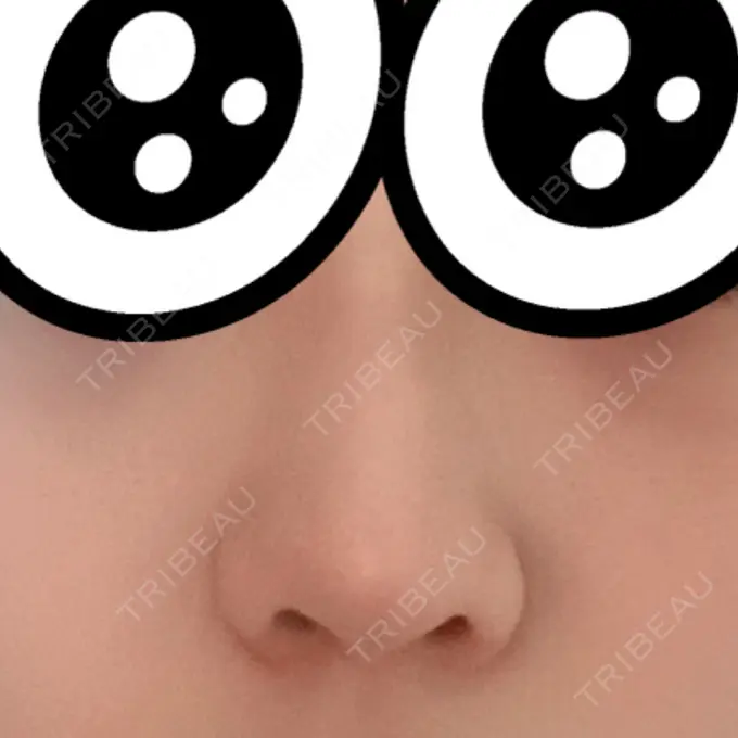 軟骨移植 GLANZ CLINIC AFTER メイン用