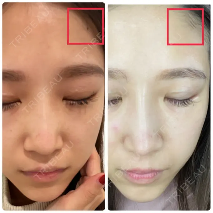 ルメッカ THE ONE. DAY 6 メイン用