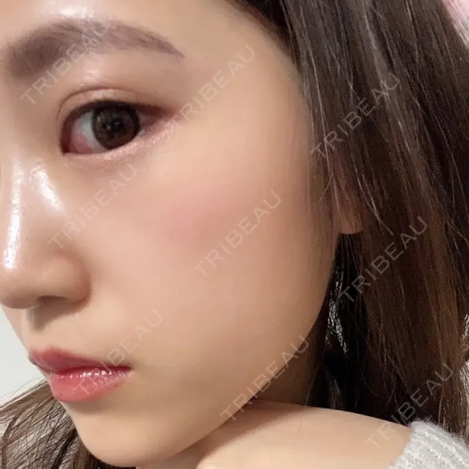 ルメッカ THE ONE. DAY 27 メイン用