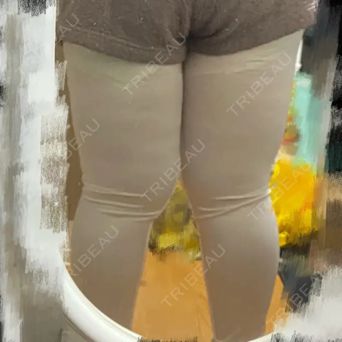 脂肪吸引（脚） THE CLINIC（ザ・クリニック） 名古屋院 DAY 0 メイン用