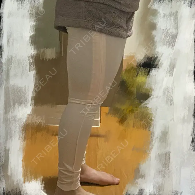 脂肪吸引（脚） THE CLINIC（ザ・クリニック） 名古屋院 DAY 0 メイン用