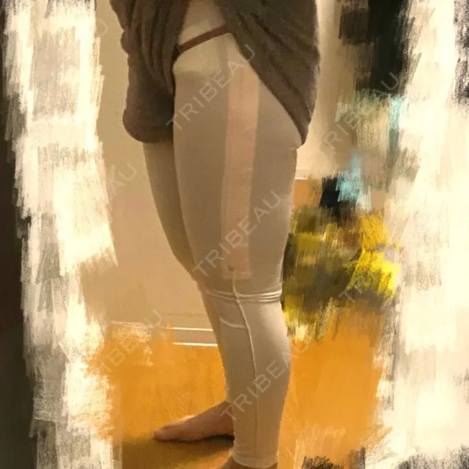 脂肪吸引（脚） THE CLINIC（ザ・クリニック） 名古屋院 DAY 0 メイン用