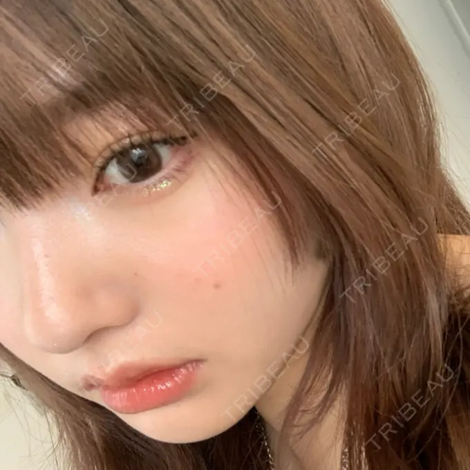 エレクトロポレーション / 毛穴洗浄（ハイドラフェイシャルなど） AURORA CLINIC（オーロラクリニック）新宿院 AFTER メイン用