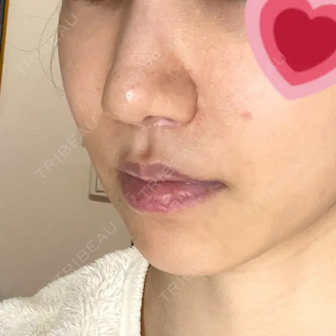 人中短縮 みずほクリニック DAY 255 メイン用