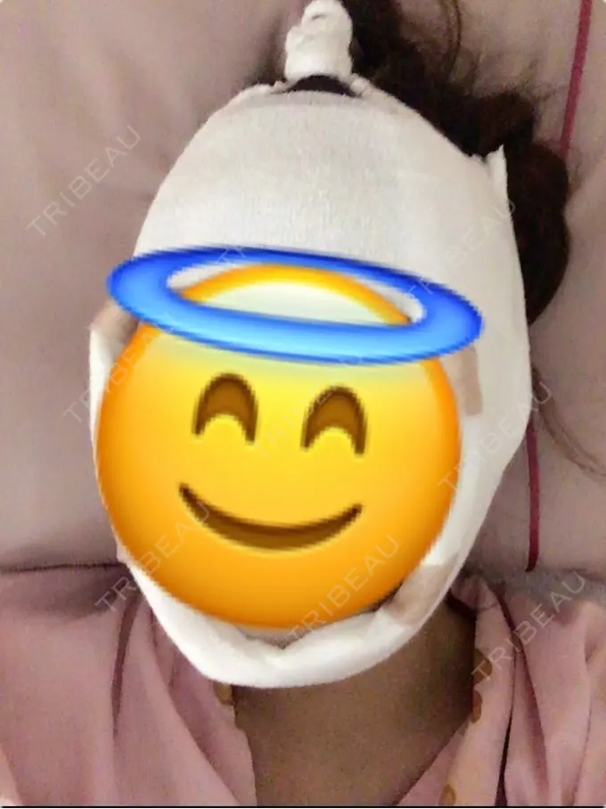 セットバック 大塚美容形成外科・歯科 大塚本院 DAY 0 メイン用