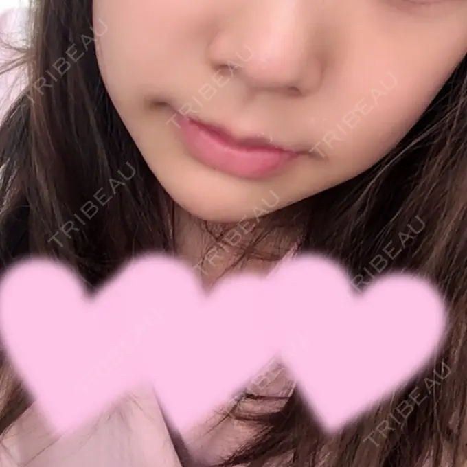 セットバック 大塚美容形成外科・歯科 大塚本院 AFTER メイン用