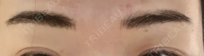 アートメイク（眉） THE ARTMAKE TOKYO 銀座院 DAY 4 メイン用