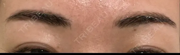 アートメイク（眉） THE ARTMAKE TOKYO 銀座院 DAY 7 メイン用