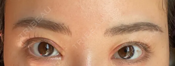 アートメイク（眉） APスキンクリニック銀座 DAY 22 メイン用