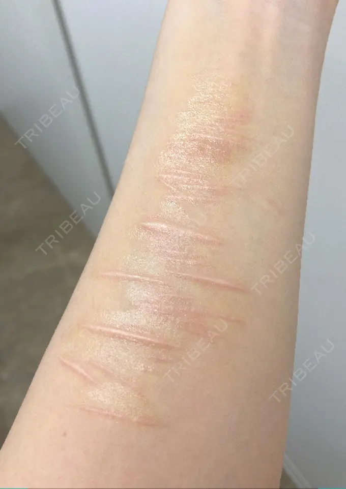 その他 / 傷跡修正 シンデレラ＆ダヴィンチクリニック DAY 0 メイン用