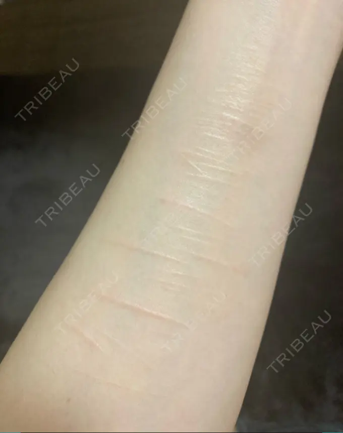 その他 / 傷跡修正 シンデレラ＆ダヴィンチクリニック DAY 1 メイン用