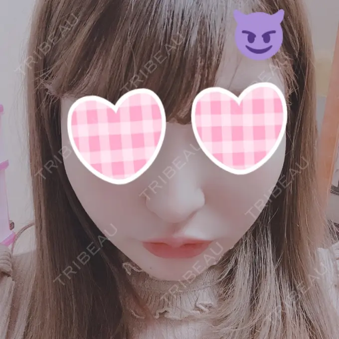 バッカルファット除去 / 脂肪吸引（顔） / ボトックス（あご） / ヒアルロン酸注入（あご） / ボトックス（エラ・小顔） / ヒアルロン酸注入（唇） / ボトックス（口角） エートップ美容整形外科 DAY 38 メイン用