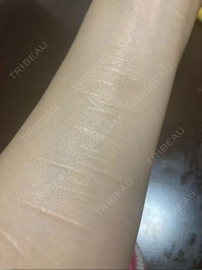 その他 / 傷跡修正 シンデレラ＆ダヴィンチクリニック AFTER メイン用