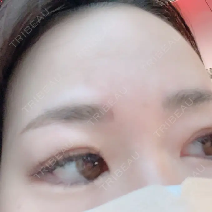 アートメイク（眉） 表参道ウィズ・クリニック DAY 0 メイン用