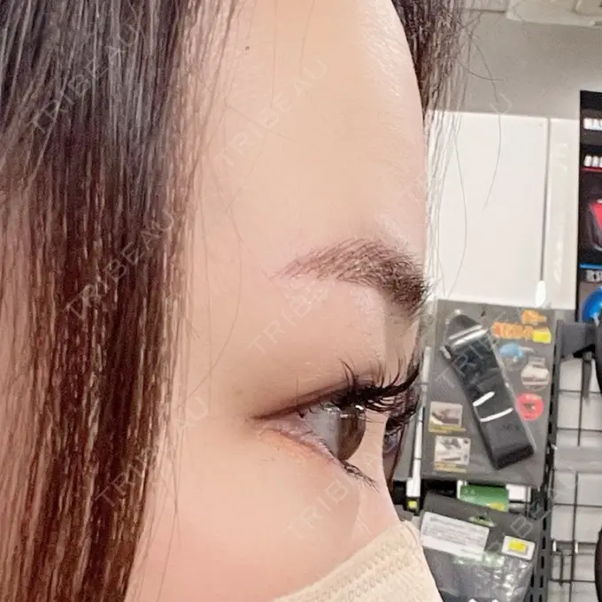 アートメイク（眉） 表参道ウィズ・クリニック DAY 1 メイン用