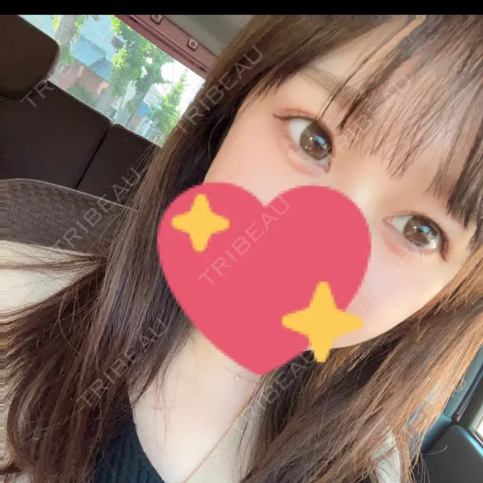 ヒアルロン酸注入（涙袋） フィラークリニック 名古屋栄院 AFTER メイン用