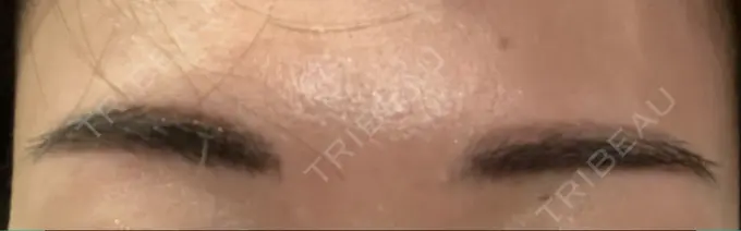 アートメイク（眉） THE ARTMAKE TOKYO 銀座院 DAY 51 メイン用