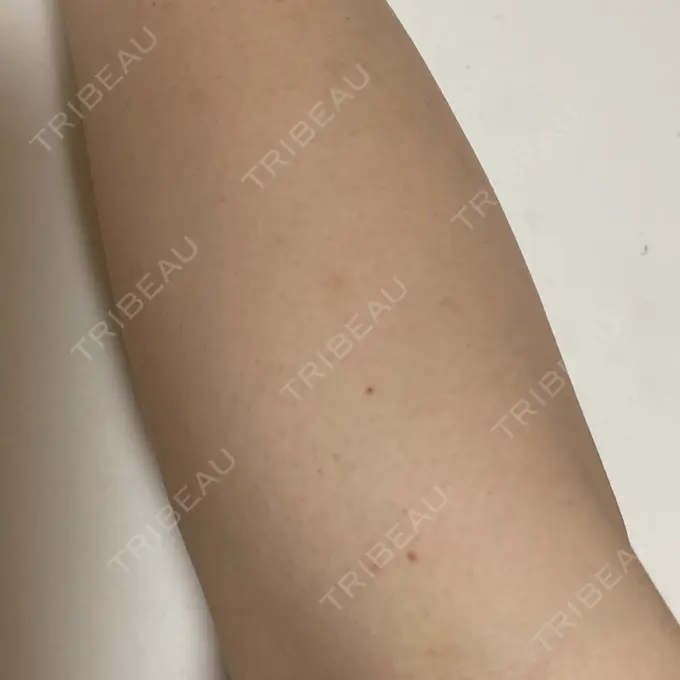 美容点滴・美容注射（ダイエット） 東京美容外科 大宮院 AFTER メイン用