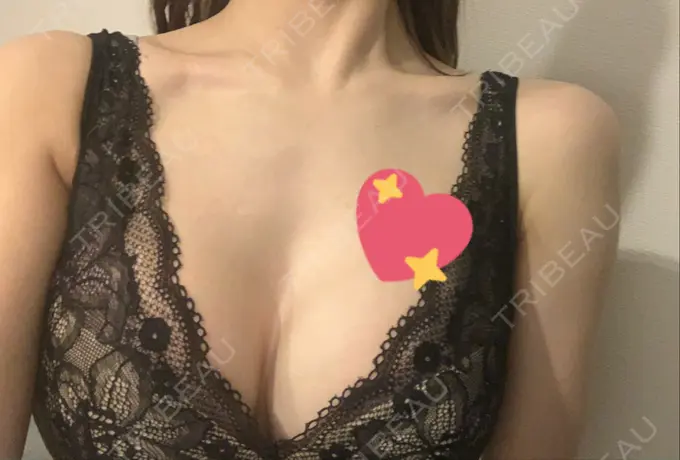 豊胸（シリコンバッグ） ジョウクリニック 大阪院 DAY 262 メイン用