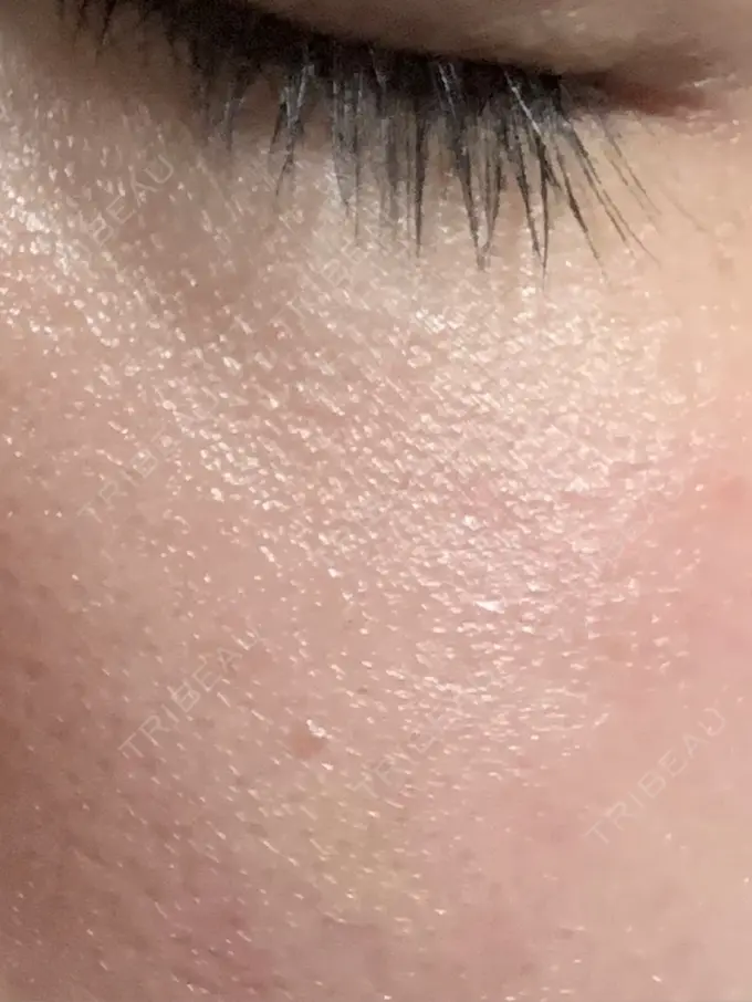 美容点滴・美容注射（美肌） / その他（肌） チョンダムジュエンクリニック DAY 4 メイン用