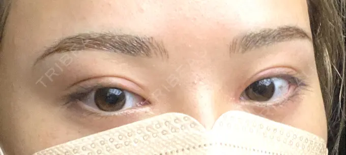 アートメイク（眉） APスキンクリニック銀座 AFTER メイン用