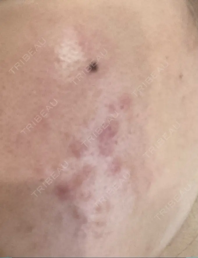 アグネス つばめ美容クリニック DAY 1 メイン用