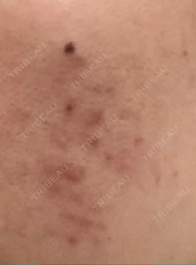 アグネス つばめ美容クリニック AFTER メイン用