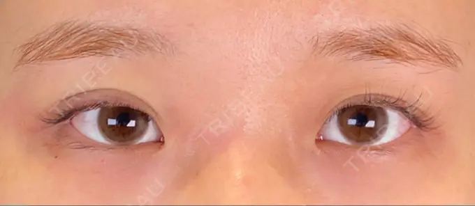 二重埋没 SOL CLINIC DAY 0 メイン用