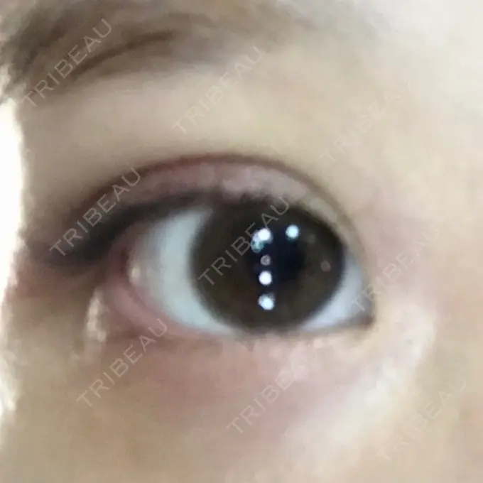 二重埋没 SOL CLINIC DAY 1 メイン用