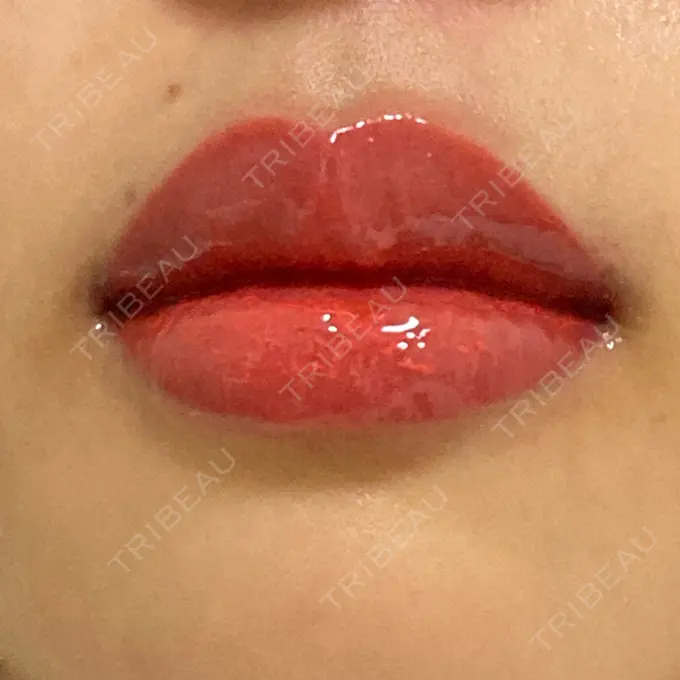 アートメイク（唇） X CLINIC 大阪院 DAY 116 メイン用