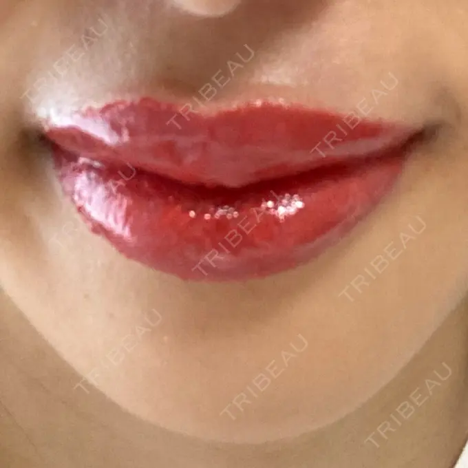 アートメイク（唇） X CLINIC 大阪院 DAY 117 メイン用