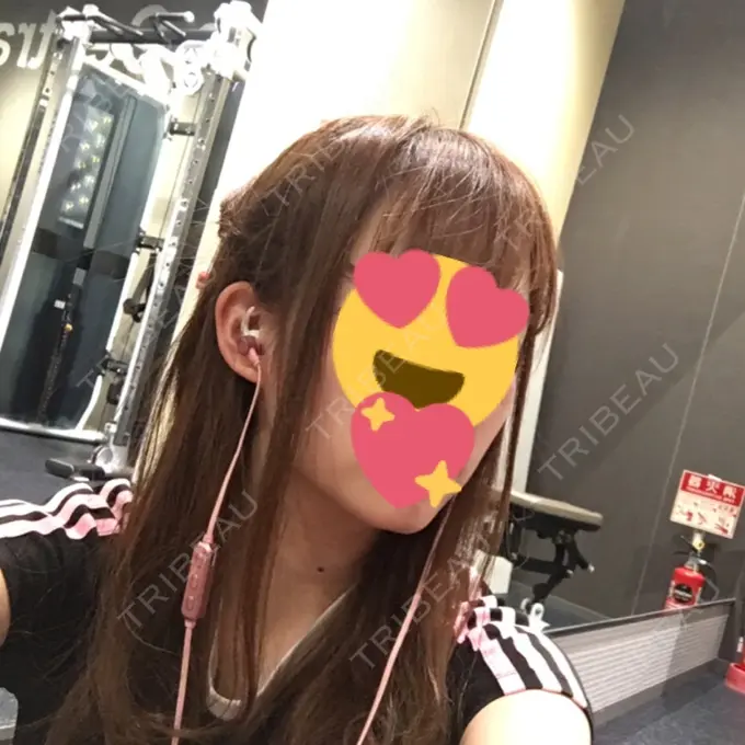 バッカルファット除去 / ボトックス（エラ・小顔） 湘南美容クリニック 秋葉原院 DAY 61 メイン用