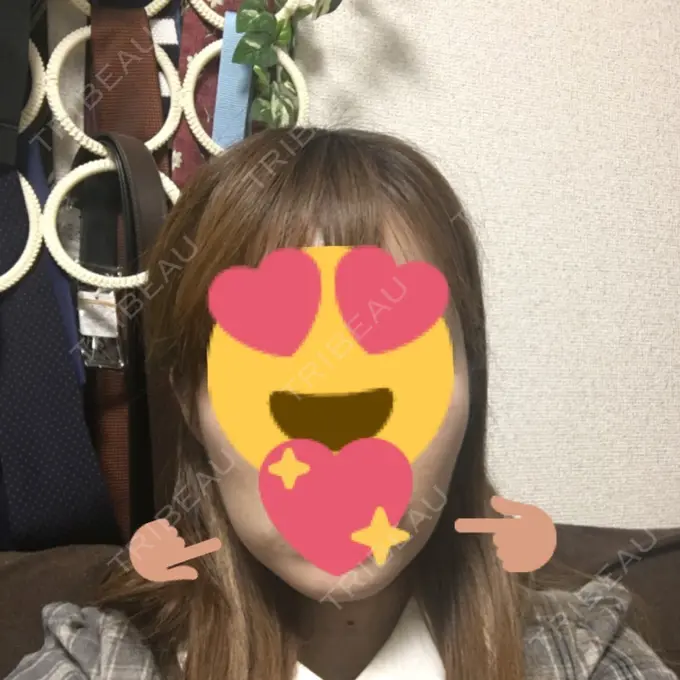 バッカルファット除去 / ボトックス（エラ・小顔） 湘南美容クリニック 秋葉原院 DAY 29 メイン用