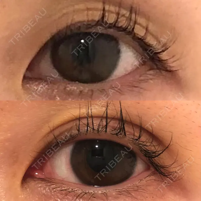 二重埋没 SOL CLINIC DAY 4 メイン用