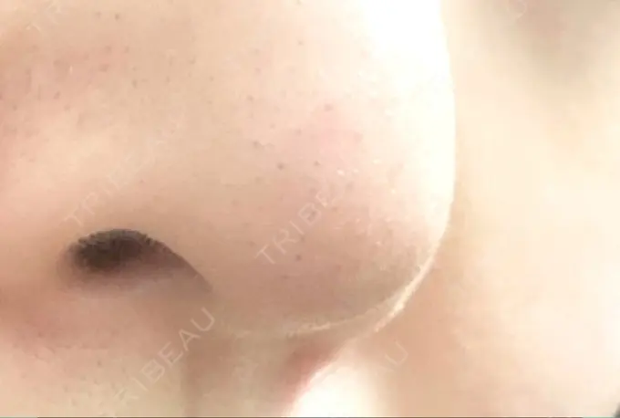 美容点滴・美容注射（美肌） / その他（肌） チョンダムジュエンクリニック DAY 21 メイン用